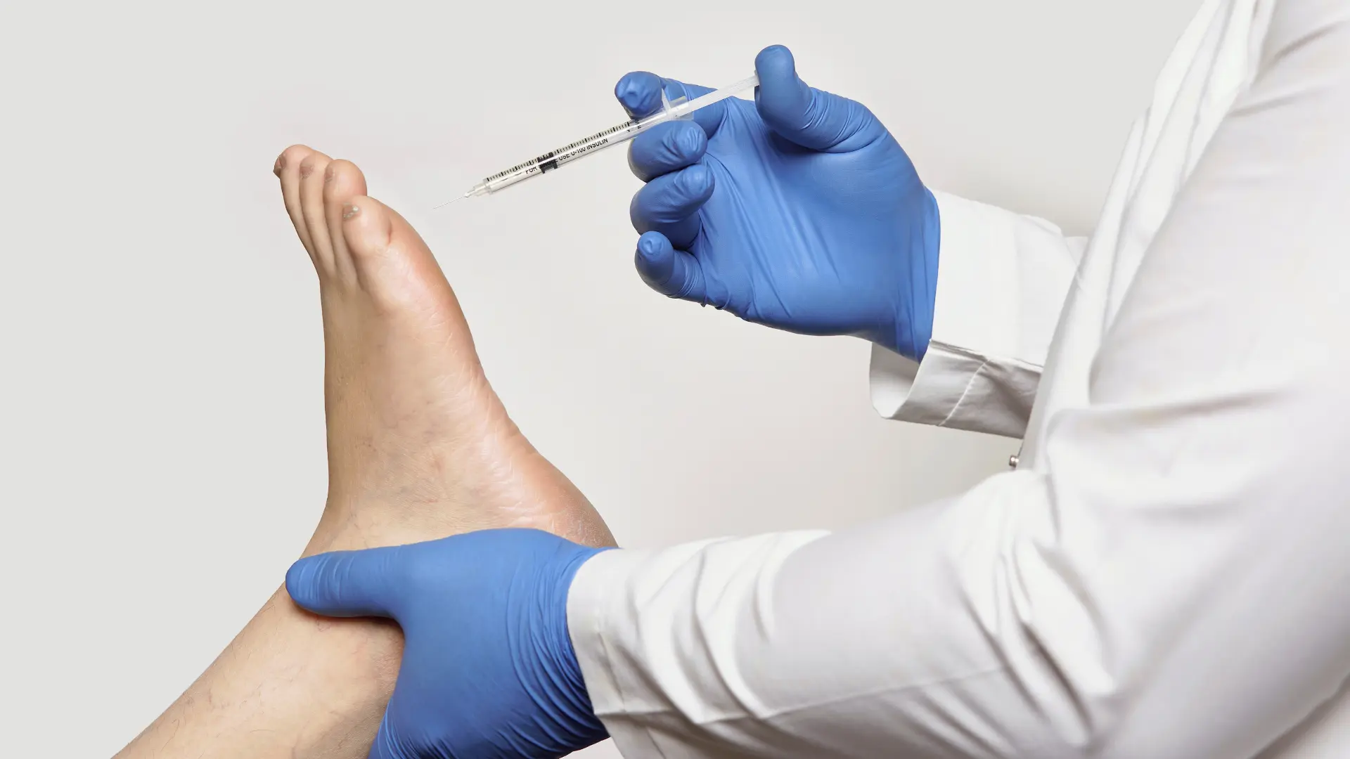 Lost cushioning under the foot and Liposana fat pad restoration